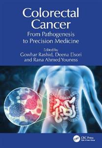 Colorectal Cancer: From Pathogenesis to Precision Medicine