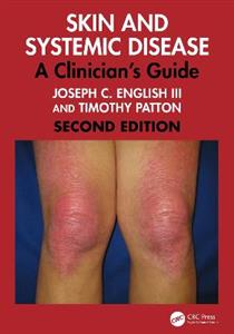 Skin and Systemic Disease: A Clinician's Guide
