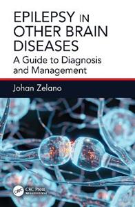 Epilepsy in Other Brain Diseases: A Guide to Diagnosis and Management