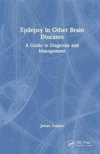 Epilepsy in Other Brain Diseases: A Guide to Diagnosis and Management