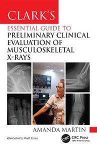 Clark's Essential Guide to Preliminary Clinical Evaluation of Musculoskeletal X-rays