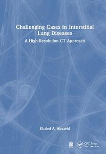 Challenging Cases in Interstitial Lung Diseases: A High-Resolution CT Approach