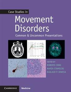 Case Studies in Movement Disorders: Common and Uncommon Presentations - Click Image to Close