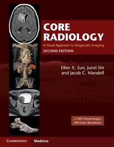 Core Radiology: A Visual Approach to Diagnostic Imaging - Click Image to Close