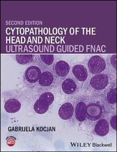Cytopathology of the Head and Neck: Ultrasound Guided FNAC - Click Image to Close