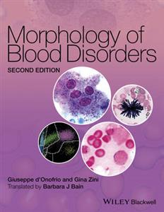 Morphology of Blood Disorders - Click Image to Close