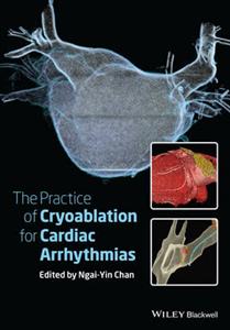 Practice of Catheter Cryoablation for Cardiac Arrhythmias, The