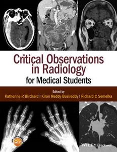 Critical Observations in Radiology for Medical Students - Click Image to Close