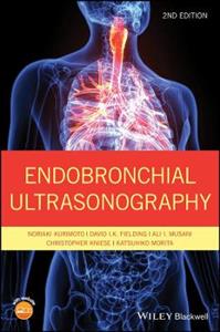 Endobronchial Ultrasonography - Click Image to Close