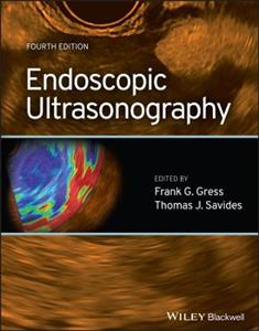 Endoscopic Ultrasonography - Click Image to Close