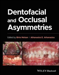 Dentofacial and Occlusal Asymmetries - Click Image to Close