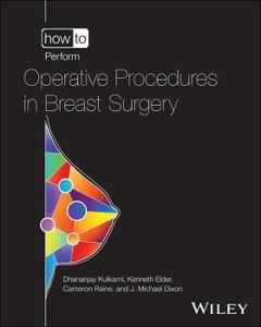 How to Perform Operative Procedures in Breast Surgery How to Perform Operative Procedures in Breast Surgery