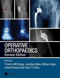 Operative Orthopaedics - Click Image to Close