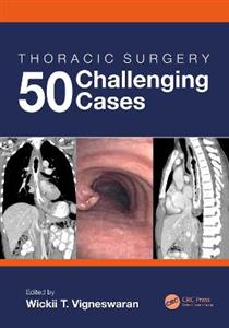 Thoracic Surgery: 50 Challenging cases - Click Image to Close