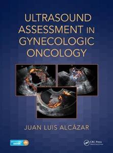 Ultrasound Assessment in Gynecologic Oncology - Click Image to Close