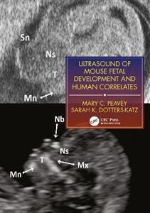 Ultrasound of Mouse Fetal Development and Human Correlates - Click Image to Close