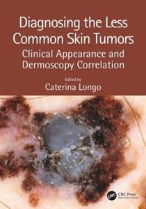 Diagnosing the Less Common Skin Tumors - Click Image to Close