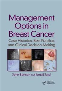 Management Options in Breast Cancer - Click Image to Close