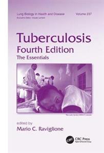 Tuberculosis - Click Image to Close