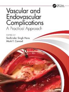 Vascular and Endovascular Complications: A Practical Approach - Click Image to Close