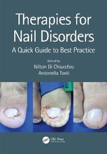 Therapies for Nail Disorders - Click Image to Close