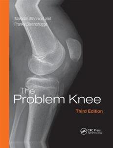 The Problem Knee - Click Image to Close
