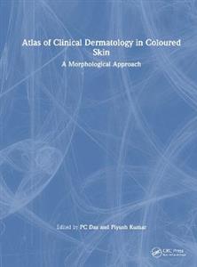 Atlas of Clinical Dermatology in Coloured Skin: A Morphological Approach