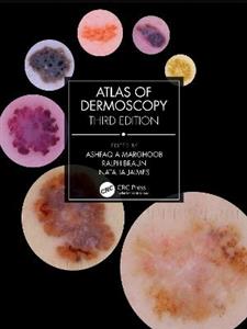 Atlas of Dermoscopy: Third Edition - Click Image to Close