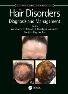 Hair Disorders - Click Image to Close