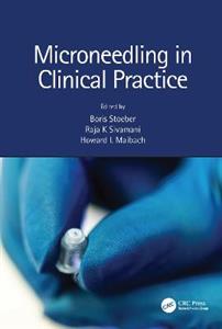 Microneedling in Clinical Practice - Click Image to Close