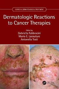 Dermatologic Reactions to Cancer Therapies