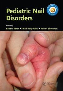 Pediatric Nail Disorders - Click Image to Close