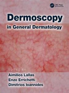 Dermoscopy in General Dermatology - Click Image to Close