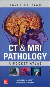 CT & MRI Pathology: A Pocket Atlas, Third Edition - Click Image to Close