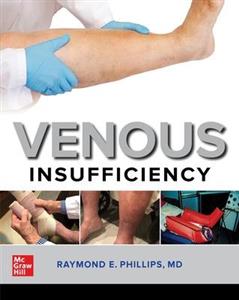 Venous Insufficiency - Click Image to Close