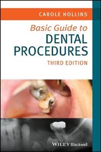 Basic Guide to Dental Procedures - Click Image to Close