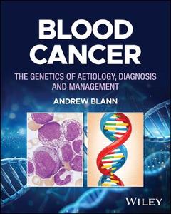 Blood Cancer: The Genetics of Aetiology, Diagnosis and Management