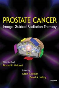 Image-Guided Radiation Therapy of Prostate Cancer