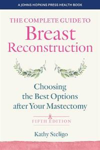 The Complete Guide to Breast Reconstruction: Choosing the Best Options after Your Mastectomy - Click Image to Close