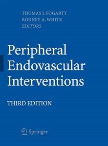 Peripheral Endovascular Interventions