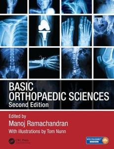 Basic Orthopaedic Sciences, Second Edition