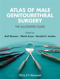 Atlas of Male Genito Urethral Surgery: The Illustrated Guide