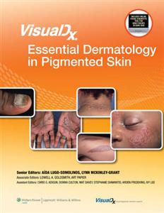 VisualDx: Essential Dermatology in Pigmented Skin (VisualDx: The Modern Library of Visual Medicine)