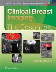 Clinical Breast Imaging: The Essentials (Essentials Series)