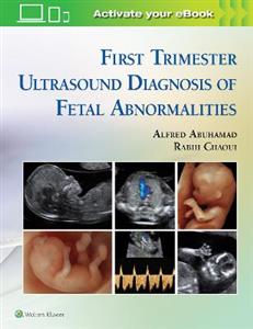 First Trimester Ultrasound Diagnosis of Fetal Abnormalities - Click Image to Close