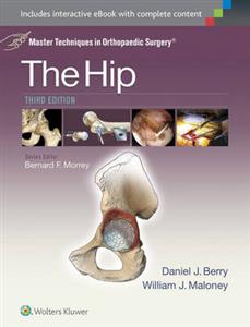 Master Techniques in Orthopaedic Surgery: The Hip (Master Techniques in Orthopaedic Surgery)