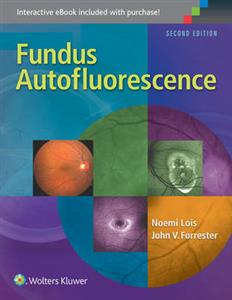 Fundus Autofluorescence - Click Image to Close