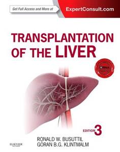 Transplantation of the Liver 3rd Edition