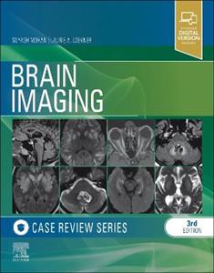 Brain Imaging: Case Review Series - Click Image to Close