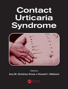 Contact Urticaria Syndrome - Click Image to Close